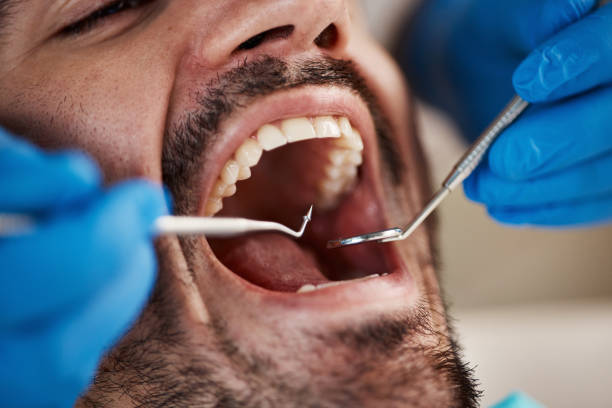 Dentist for Dental Trauma in NV